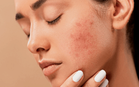 Skin Problem And Solution